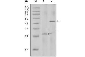 Western Blot showing IL2 antibody used against full-length IL2 recombinant protein with Trx tag (1) and full-length IL2-hIgGFc transfected HEK293 cell lysate (2). (IL-2 Antikörper)