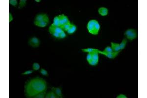 Immunofluorescence staining of MCF-7 cells with ABIN7167413 at 1:105, counter-stained with DAPI.