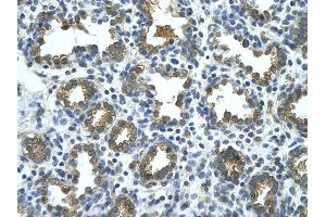 Rabbit Anti-GUSB Antibody       Paraffin Embedded Tissue:  Human alveolar cell   Cellular Data:  Epithelial cells of renal tubule  Antibody Concentration:   4. (Glucuronidase beta Antikörper  (C-Term))