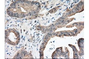 Immunohistochemical staining of paraffin-embedded Human pancreas tissue using anti-NXNL2 mouse monoclonal antibody. (NXNL2 Antikörper)