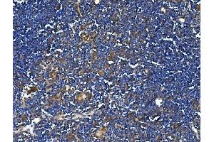 IHC analysis of TRIM6 using anti-TRIM6 antibody (ABIN7601905). (TRIM6 Antikörper  (AA 50-349))