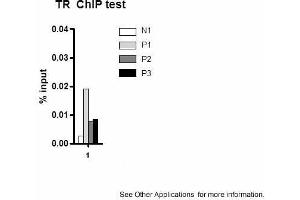 Application: ChIPSample Type: mouse liver tissueChromatin Used: 100ug tissueAntibody Used: 10ug  Image Submitted by: Joanna DiSpiritoUniversity of Pennsylvania (THRB Antikörper  (N-Term))