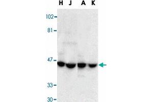 Western blot analysis of DFFA in HeLa (H), Jurkat (J), A-431 (A), and K-562 (K) whole cell lysate with DFFA polyclonal antibody  at 1 : 1000 dilution. (DFFA Antikörper  (AA 313-331))