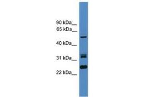 Image no. 1 for anti-Leucine Rich Repeat (In FLII) Interacting Protein 2 (LRRFIP2) (AA 51-100) antibody (ABIN6745323) (LRRFIP2 Antikörper  (AA 51-100))