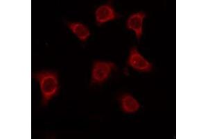 ABIN6275034 staining Hela by IF/ICC. (CD55 Antikörper  (Internal Region))