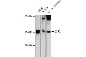 Western blot analysis of extracts of various cell lines, using CSF2 antibody (ABIN6130426, ABIN6139094, ABIN6139095 and ABIN6221725) at 1:500 dilution. (GM-CSF Antikörper  (AA 18-144))