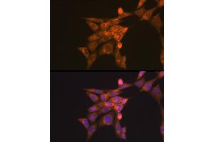 Immunofluorescence (IF) image for anti-Folate Receptor 1 (Adult) (FOLR1) (AA 25-93) antibody (ABIN7267224)