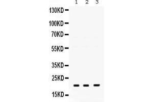 Western blot analysis of GTPase HRAS expression in rat brain extract ( Lane 1), mouse brain extract ( Lane 2) and A549 whole cell lysates ( Lane 3). (HRAS Antikörper  (C-Term))