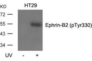 Western blot analysis of extracts from HT29 cells, untreated or treated with UV using Ephrin-B2 (Phospho-Tyr330).