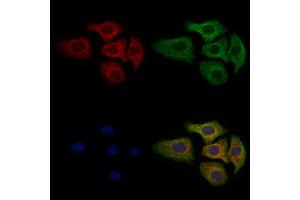 ABIN6263407 and ABIN6279151 staining Hela cells by IF/ICC. (MT-ATP6 Antikörper  (Internal Region))