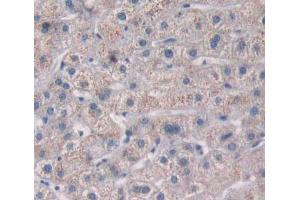 Used in DAB staining on fromalin fixed paraffin- embedded liver tissue (PTP4A2 Antikörper  (AA 1-167))
