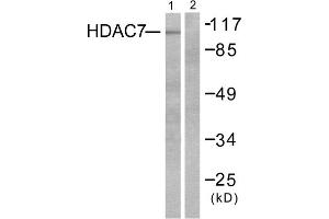 Western blot analysis of extracts from HuvEc cells, using HDAC7 antibody (ABIN5976424). (HDAC7 Antikörper  (C-Term))