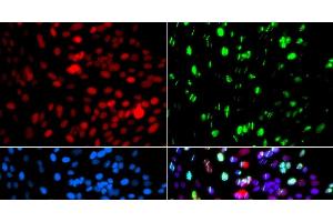 Immunofluorescence analysis of GFP-RNF168 transgenic U2OS cells using POLD3 Polyclonal Antibody (POLD3 Antikörper)
