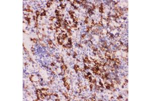 Immunohistochemistry (IHC) image for anti-Myeloid Differentiation Primary Response Gene (88) (MYD88) (AA 44-264) antibody (ABIN3043887)