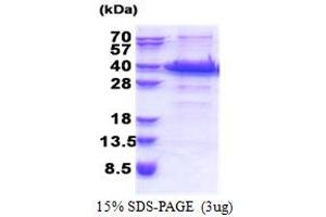 Insulin-Like Growth Factor Binding Protein 7 (IGFBP7) (AA 27-282) protein (His tag)
