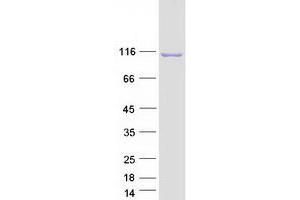 Western Blotting (WB) image for Inositol Polyphosphate-4-Phosphatase, Type I, 107kDa (INPP4A) (Transcript Variant D) protein (Myc-DYKDDDDK Tag) (ABIN2723481)