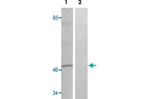 Western blot analysis of Lane 1: heat shock treated HT-29 cells, Lane 2: antigen-specific peptide treated HT-29 cells with DPYSL2 (phospho T509) polyclonal antibody  at 1:500-1000 dilution. (DPYSL2 Antikörper  (pThr509))