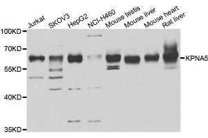 Western blot analysis of extracts of various cell lines, using KPNA5 antibody. (KPNA5 Antikörper)