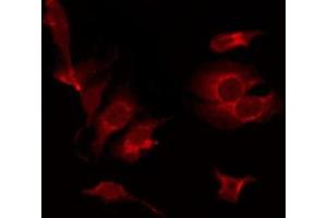 Immunofluorescence (fixed cells) (IF/ICC) image for anti-LIM Domain Kinase 1 (LIMK1) (pThr508) antibody (ABIN6255701)