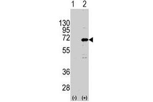 Western blot analysis of CNOT4 (arrow) using rabbit CNOT4 polyclonal antibody . (CNOT4 Antikörper  (N-Term))