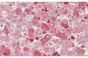 Detection of NRP1 in Human Liver Tissue using Polyclonal Antibody to Neuropilin 1 (NRP1) (Neuropilin 1 Antikörper  (AA 646-814))