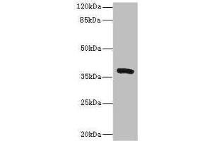 Western blot All lanes: TMEM64 antibody at 8 μg/mL + Mouse brain tissue Secondary Goat polyclonal to rabbit IgG at 1/10000 dilution Predicted band size: 40, 13, 15, 34 kDa Observed band size: 40 kDa (TMEM64 Antikörper  (AA 40-118))