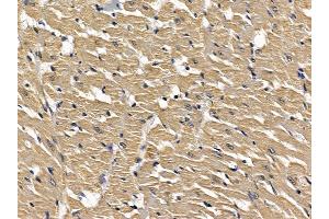 ABIN6257613 and ABIN6274480 at 1/100 staining rat heart tissue by IHC-P.