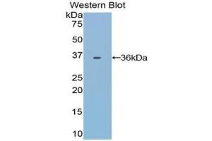 Western blot analysis of the recombinant protein. (Transferrin Antikörper)