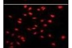 Negative control of hela cells without Alexa-Fluor-546-conjugated donkey anti-rabbit lgG (H+L).