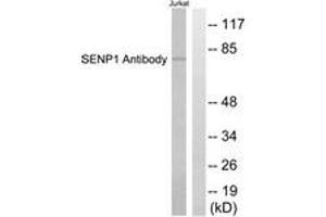 Western blot analysis of extracts from Jurkat cells, using SENP1 Antibody. (SENP1 Antikörper  (AA 1-50))