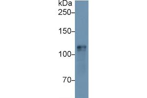Western blot analysis of Mouse Heart lysate, using Mouse HK1 Antibody (1 µg/ml) and HRP-conjugated Goat Anti-Rabbit antibody ( (Hexokinase 1 Antikörper  (AA 137-270))