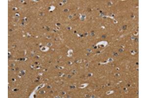 The image on the left is immunohistochemistry of paraffin-embedded Human brain tissue using ABIN7130524(PAEP Antibody) at dilution 1/60, on the right is treated with fusion protein. (PAEP Antikörper)