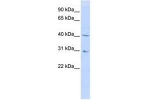 Image no. 1 for anti-Dihydroorotate Dehydrogenase (DHODH) (AA 180-229) antibody (ABIN6740743) (DHODH Antikörper  (AA 180-229))