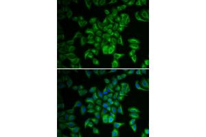 Immunofluorescence analysis of A549 cells using FXN antibody.
