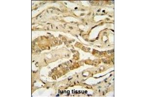 Immunohistochemistry (Paraffin-embedded Sections) (IHC (p)) image for anti-NADH Dehydrogenase (Ubiquinone) Complex I, Assembly Factor 3 (NDUFAF3) (AA 12-40), (N-Term) antibody (ABIN654942)