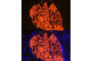 Immunofluorescence analysis of Mouse placenta using HB antibody (ABIN6129603, ABIN6141637, ABIN6141638 and ABIN6224486) at dilution of 1:100 (40x lens). (HBa2 Antikörper  (AA 1-142))