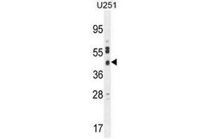 CB018 Antibody (C-term) western blot analysis in U251 cell line lysates (35µg/lane). (SLC35F6 Antikörper  (C-Term))