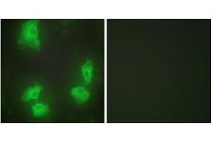 Immunofluorescence analysis of HeLa cells, using CDK5R1 antibody. (CDK5R1 Antikörper  (N-Term))