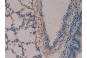 IHC-P analysis of Rat Lung Tissue, with DAB staining. (Periostin Antikörper  (AA 659-810))