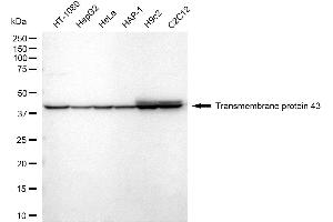 Western blotting analysis using transmembrane protein 43 antibody (ABIN7800622).
