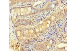 Immunohistochemistry of paraffin-embedded human small intestine tissue using ABIN7166174 at dilution of 1:100 (TESPA1 Antikörper  (AA 251-521))