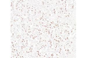 Immunohistochemistry (IHC) image for anti-Insulinoma-Associated 1 (INSM1) (AA 75-125) antibody (ABIN7795670)