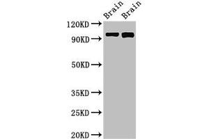 Western Blot Positive WB detected in: Rat brain tissue, Mouse brain tissue All lanes: ATP6V0A1 antibody at 3 μg/mL Secondary Goat polyclonal to rabbit IgG at 1/50000 dilution Predicted band size: 97, 96 kDa Observed band size: 97 kDa (ATP6VA1 (AA 80-260), (Isoform 1) Antikörper)