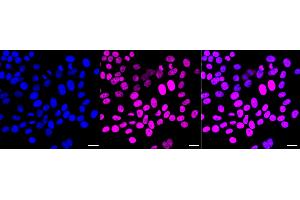 Immunocytochemical staining of HepG2 cells with Chromodomain helicase DNA binding protein 3 antibody (ABIN7798069), 1:1,000). (Rekombinanter CHD3 Antikörper)