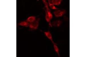 ABIN6275175 staining  HepG2 cells by IF/ICC. (GNAI3 Antikörper  (N-Term))