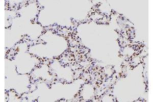 ABIN6276858 at 1/100 staining Rat lung tissue by IHC-P. (POLR2E Antikörper  (Internal Region))