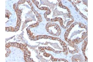 Immunohistochemistry (IHC) image for anti-Keratin 15 (KRT15) antibody (ABIN6939913)