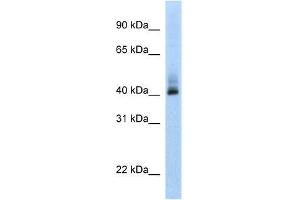 Human MCF-7; WB Suggested Anti-ANKRD42 Antibody Titration: 0. (ANKRD42 Antikörper  (N-Term))
