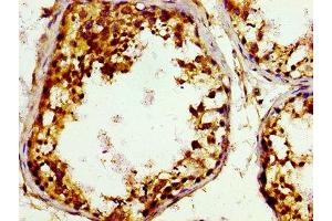 Immunohistochemistry of paraffin-embedded human testis tissue using ABIN7148935 at dilution of 1:100 (GAK Antikörper  (AA 939-1086))