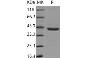Western Blotting (WB) image for Pepsinogen C (PGC) protein (His tag) (ABIN7197294)